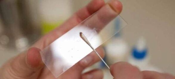 Struganje za jaja crva